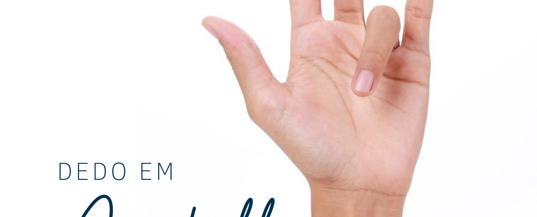 Revista Brasileira de Ortopedia - Tratamento do Dedo em Gatilho